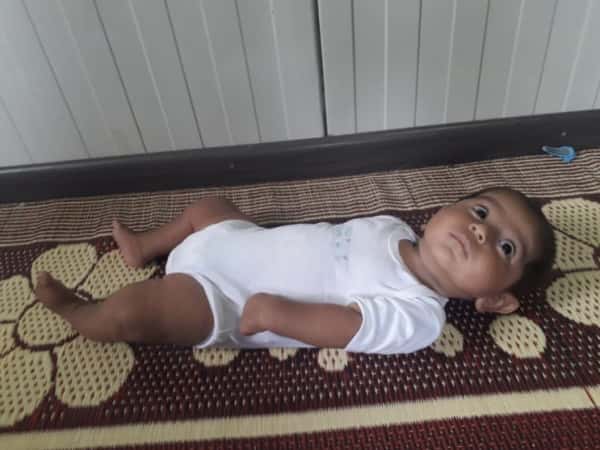 A baby suffers from hand drop