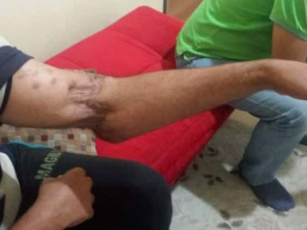 An injured man in need for a surgery