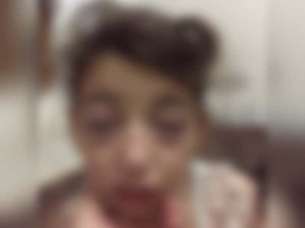 A child needs to pay for her treatment