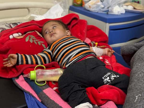 A Burned Foot, a Childhood on Hold