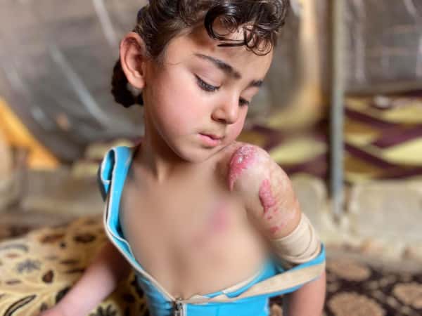 الحالات الانسانية الطارئة