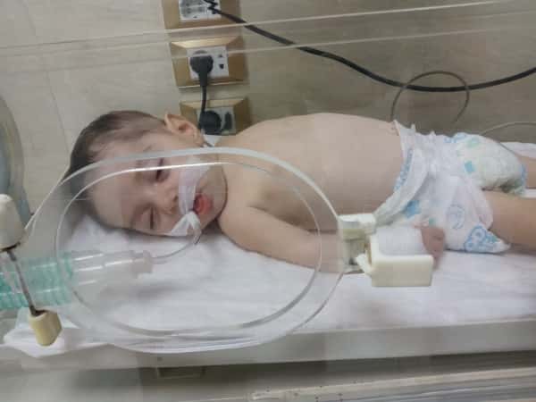 Ammar is a newborn in need of help