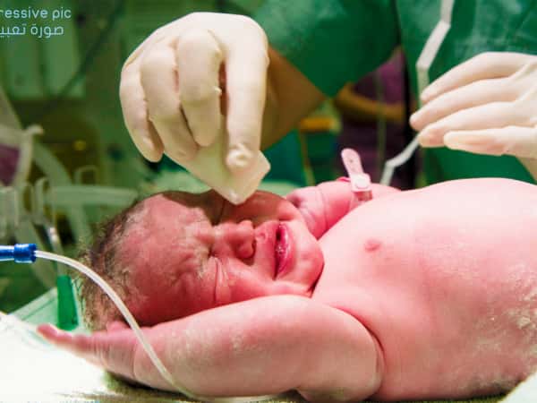 CS is needed for a 9th month pregnant