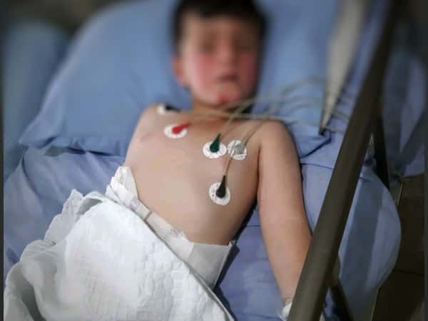 kid with right side paralysis