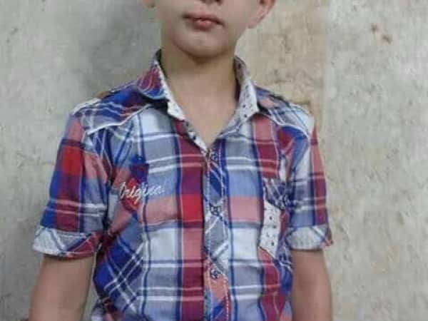 10 years old kid needs orthdonotic
