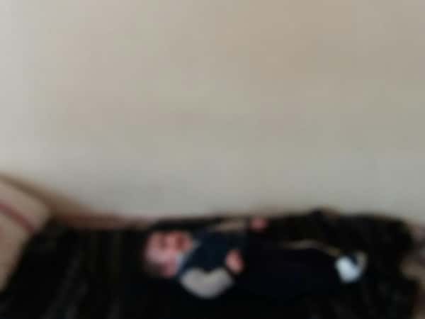 طفل يعاني من ماء زرقاء في العين وبحاجة قطرات بشكل دائم