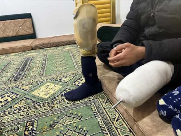 إصابة مضاعفة وحادث يزيد الثقل