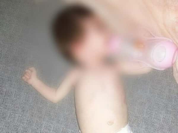 A little girl in Syria needs treatment expenses.