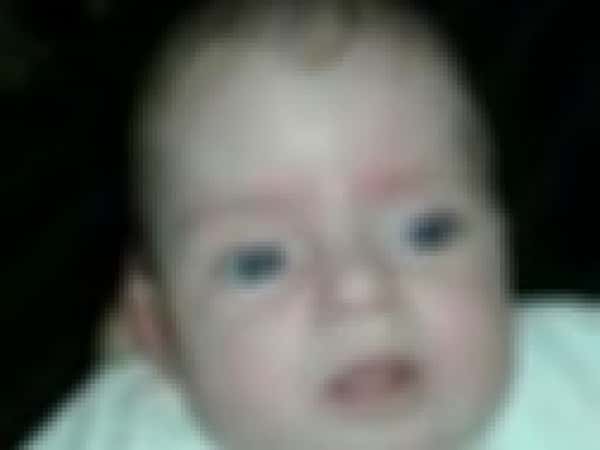 Infant needs treatment expenses