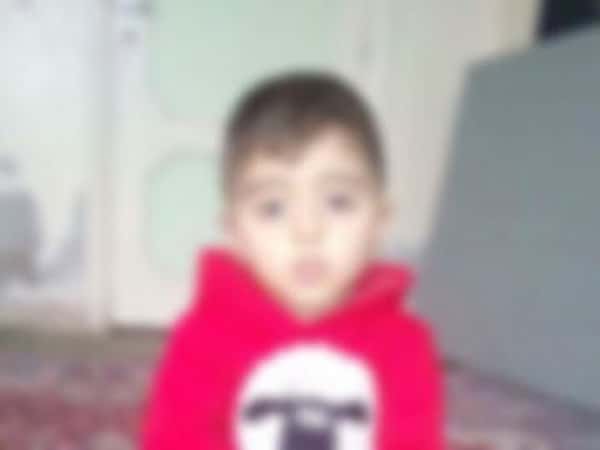 Child needing several surgeries