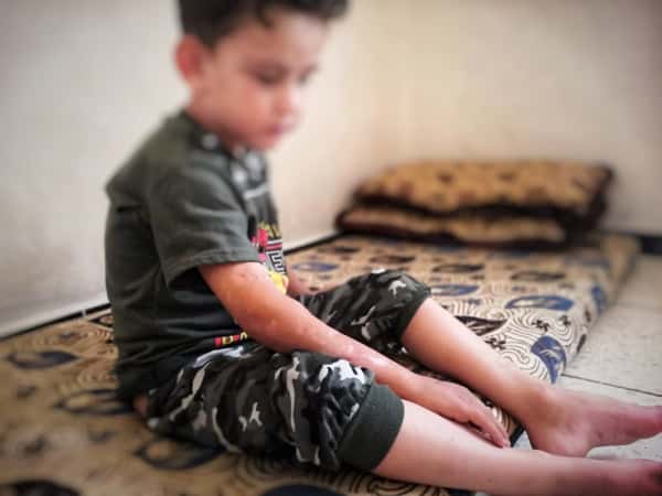 نجاة طفل من الموت بأعجوبة واستشهاد خاله إثر سقوط صاروخ