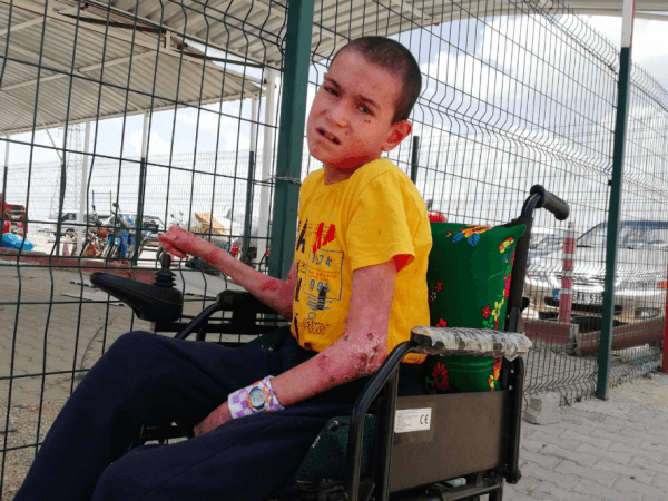 A child needs medicines