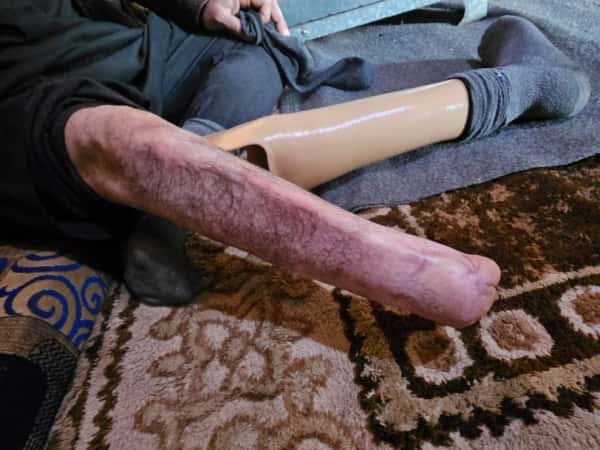 A severed leg and a tent that offers no protection