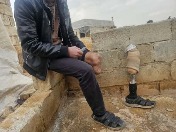 ساقٌ بُترت ومسؤولية لم تُبتر