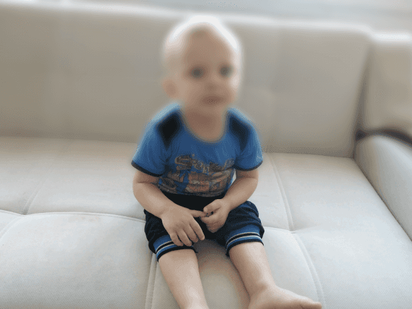 A child suffer from aortic stenosis