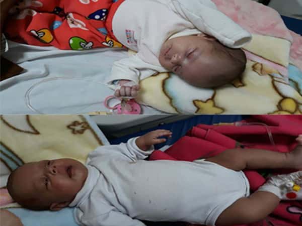 A twins need urgent medical care