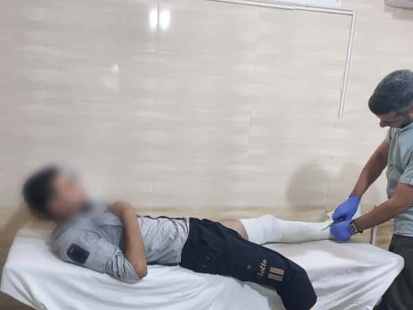 His leg is amputated, and his other leg suffered a tear while he was searching for a way to provide for his children. He urgently needs surgery!