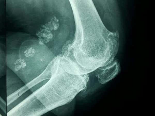 A lady in need of surgery