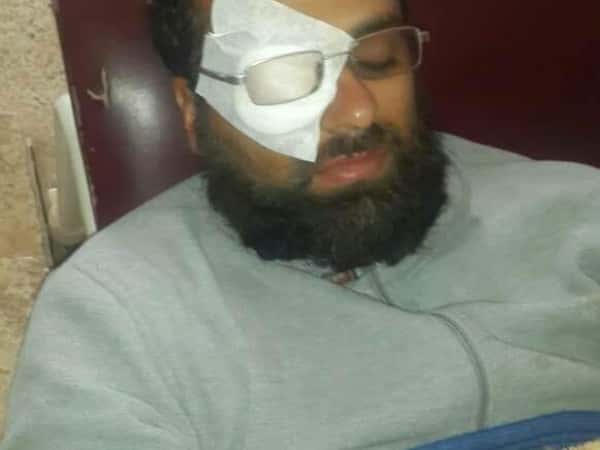 A young man needs an eye surgery