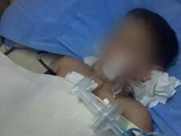 treatment for a little boy