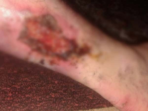 Hamza urgently needs your help