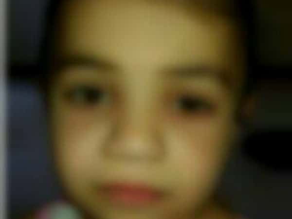 eye surgery for a little girl