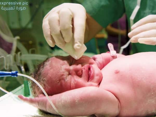 Pregnant woman needing c-section