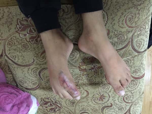 Young man needing surgery expenses