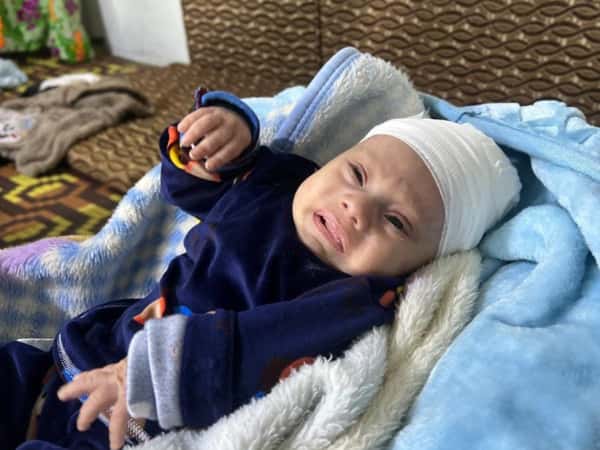 A Child’s Skull Eroding, A Mother Refusing to Give Up