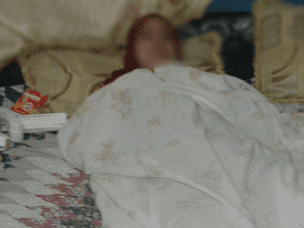 Adult woman have gallstones