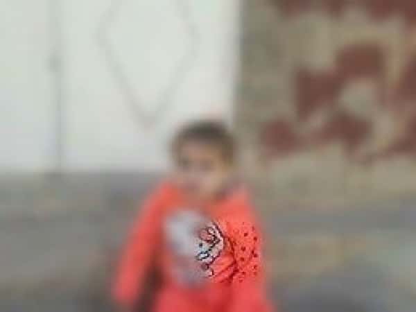 little girl with motor developmental delay
