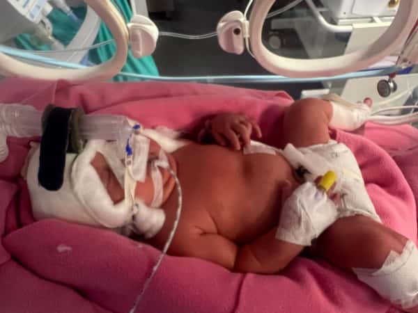 الحالات الانسانية المستعجلة