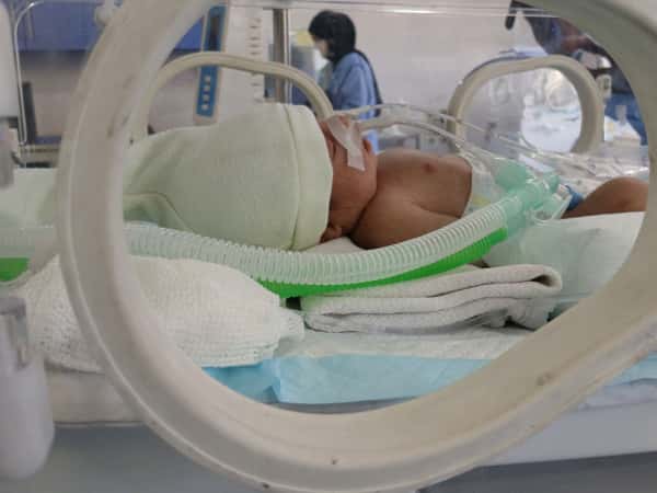 Yasmin needs to stay in an incubator to ensure her lungs fully develop.