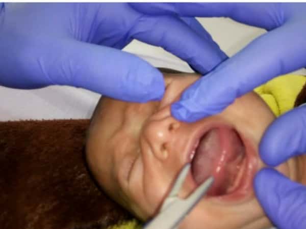 A little baby in need for treatment