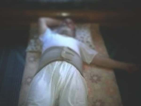 A man suffers from Spondylolisthesis!