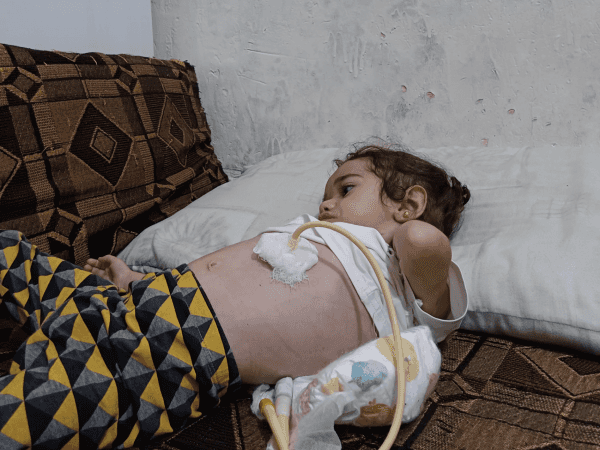 Yasmine needs urgent surgery