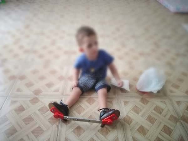 A child with cerebral atrophy