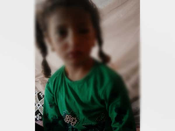 A girl with Congenital Heart Defect!