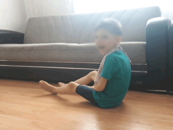 A child suffers from speech defects and Bradyesthesia