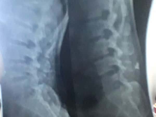 A man needs medical treatment