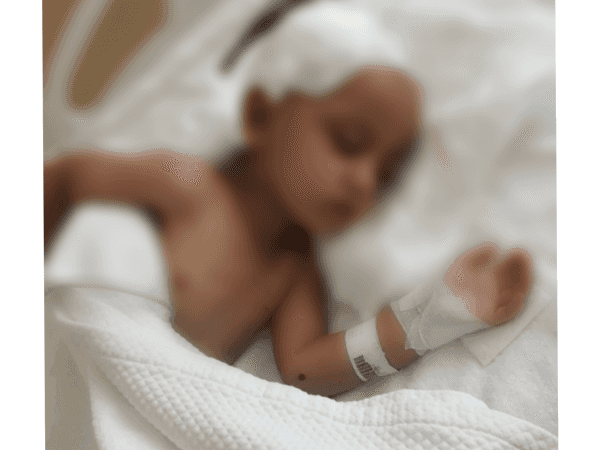A child with Leukemia