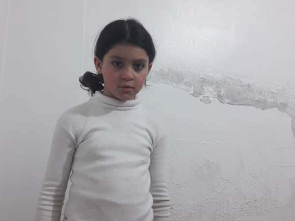 A child suffering form Precocious Puberty