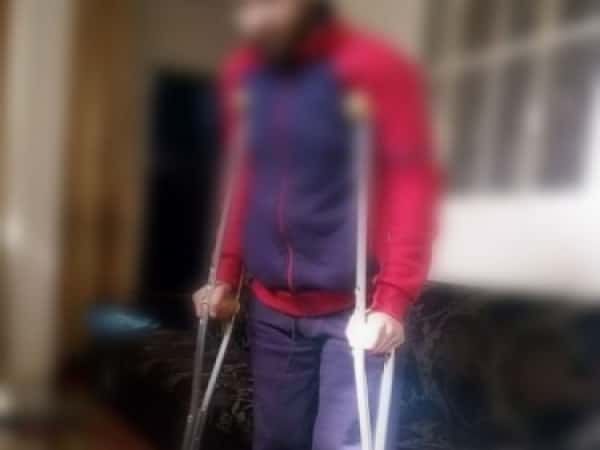 Nazem Needs a Hip Replacement Surgery