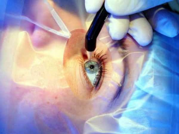 Urgent corneal surgery