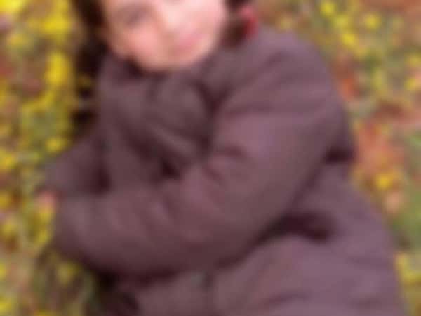 Child burned by shelling