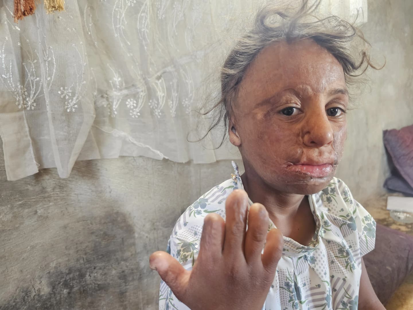 Urgent humanitarian cases